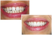 Brentwood Center for Cosmetic Dentistry Los Angeles CA